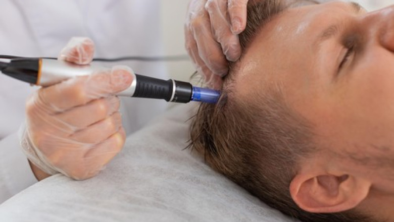 un-barbat-in-varsta-de-38-de-ani-a-murit-in-timpul-unei-proceduri-de-transplant-de-par-in-turcia_688f972bbefdc