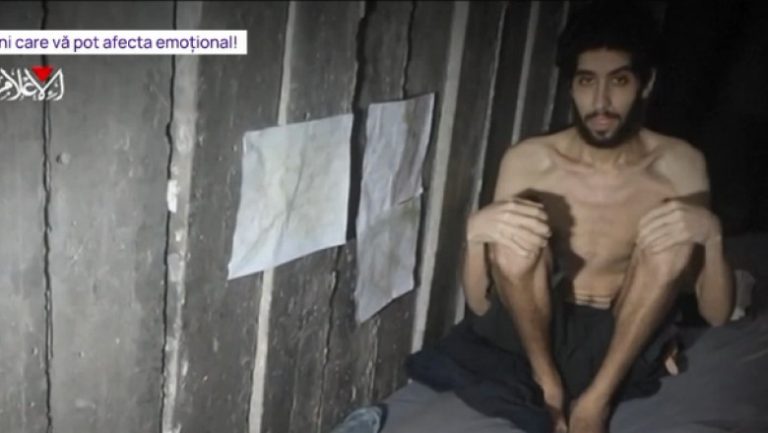 video-imagini-impresionante-cu-un-ostatic-hamas-dupa-2-ani-de-captivitate-tanarul-de-24-de-ani-e-de-nerecunoscut_688f2722b21e9